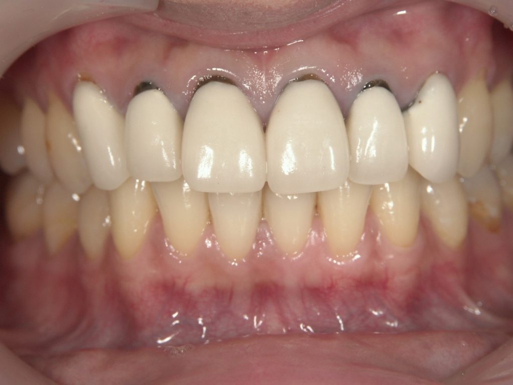 before cosmetic dentistry