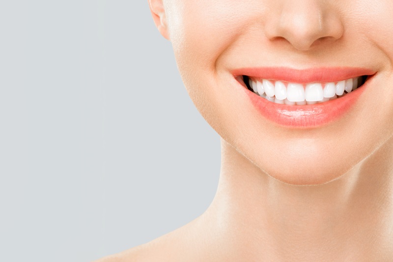 Gummy Smile Correction Treatment at WhiteWhite